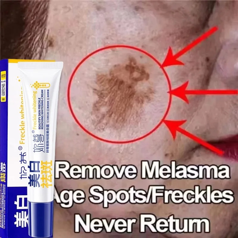 Skincare Korea - كريم تبييض قوي لإزالة البقع يفتيح