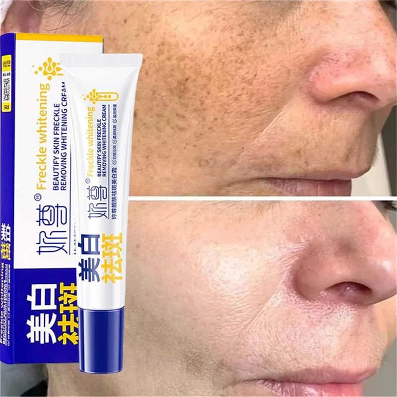 كريم تبييض قوي لإزالة البقع يف - مراجعة Skincare Korea وسعره