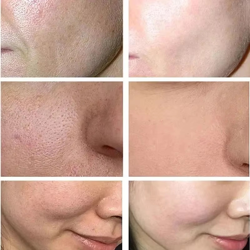 كريم حمض الساليسيليك لتقليل ال - مراجعة Skincare Korea وسعره