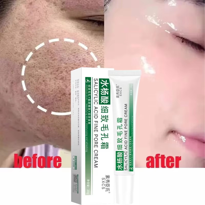 كريم حمض الساليسيليك لتقليل ال - مراجعة Skincare Korea وسعره