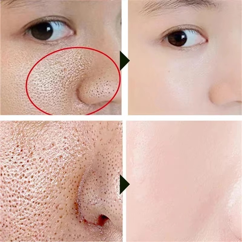كريم حمض الساليسيليك لتقليل ال - مراجعة Skincare Korea وسعره